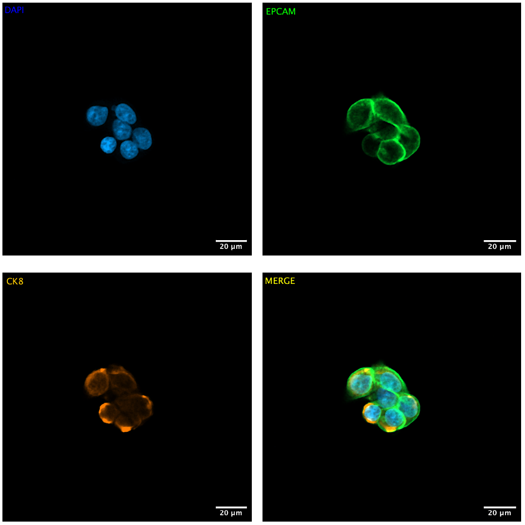 DAPI EpCAM CK8 images_Cell Clusters