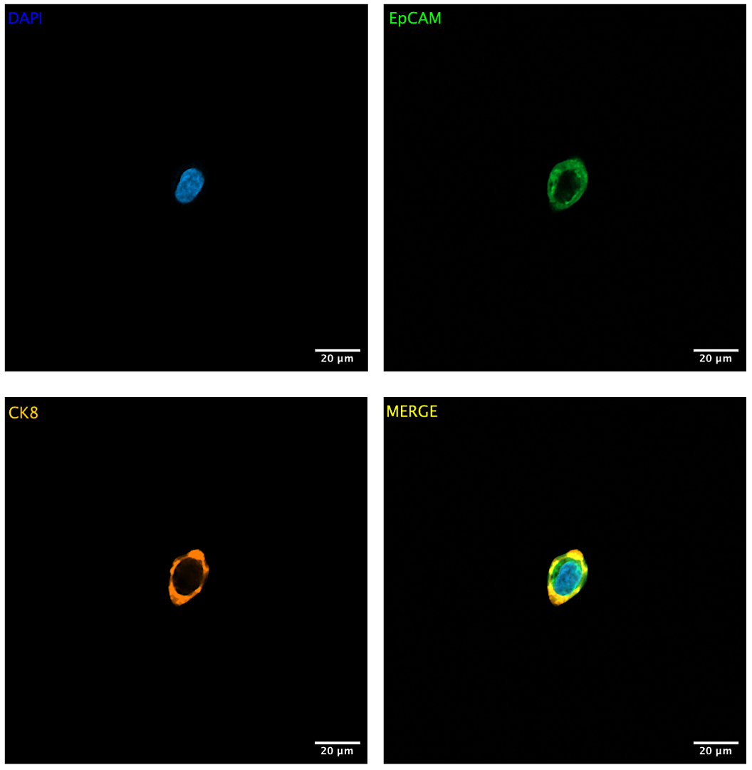 DAPI EpCAM CK8 images_Single Cells