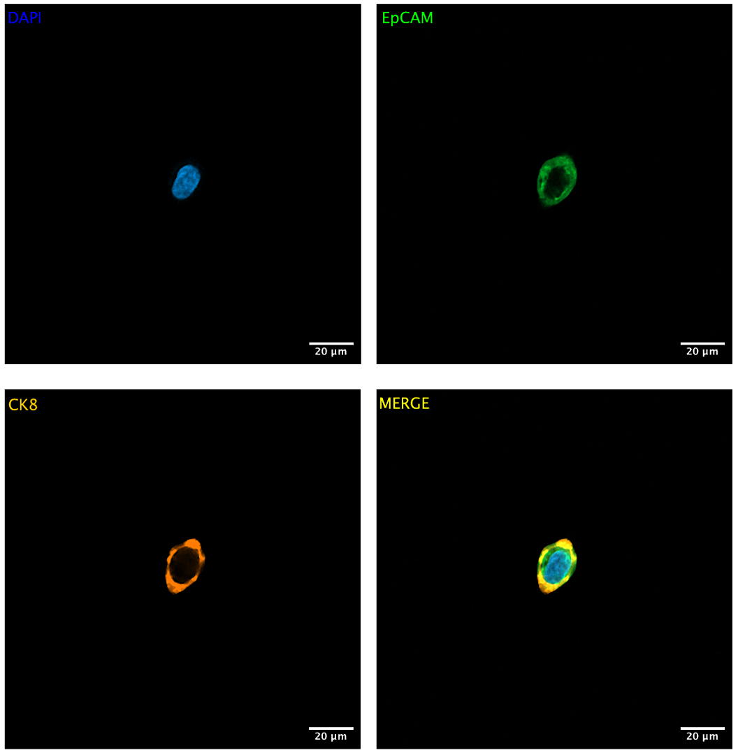 Immunofluorescent microscopy of isolated single cells
